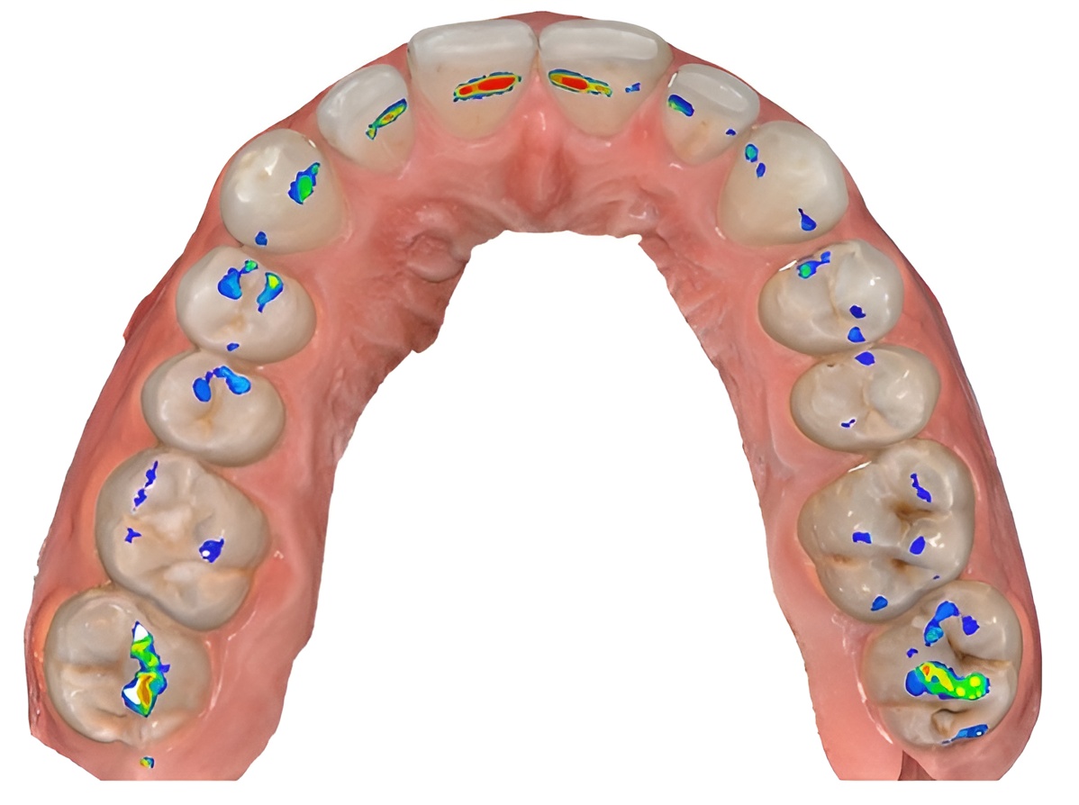 Physiologie de l'occlusion